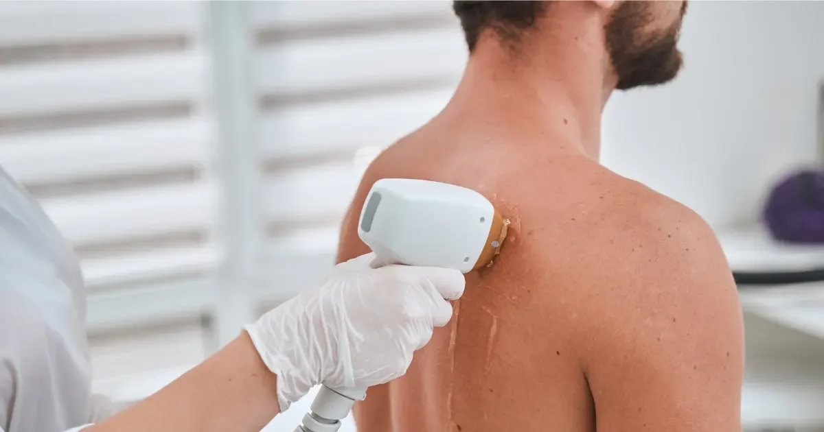 Expert Laser Hair Removal for Face and Body