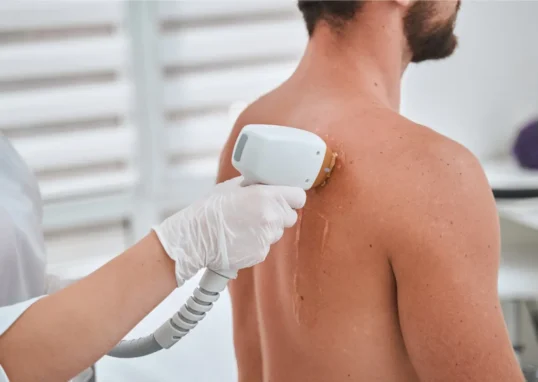Expert Laser Hair Removal for Face and Body