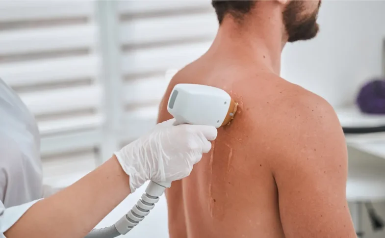Expert Laser Hair Removal for Face and Body