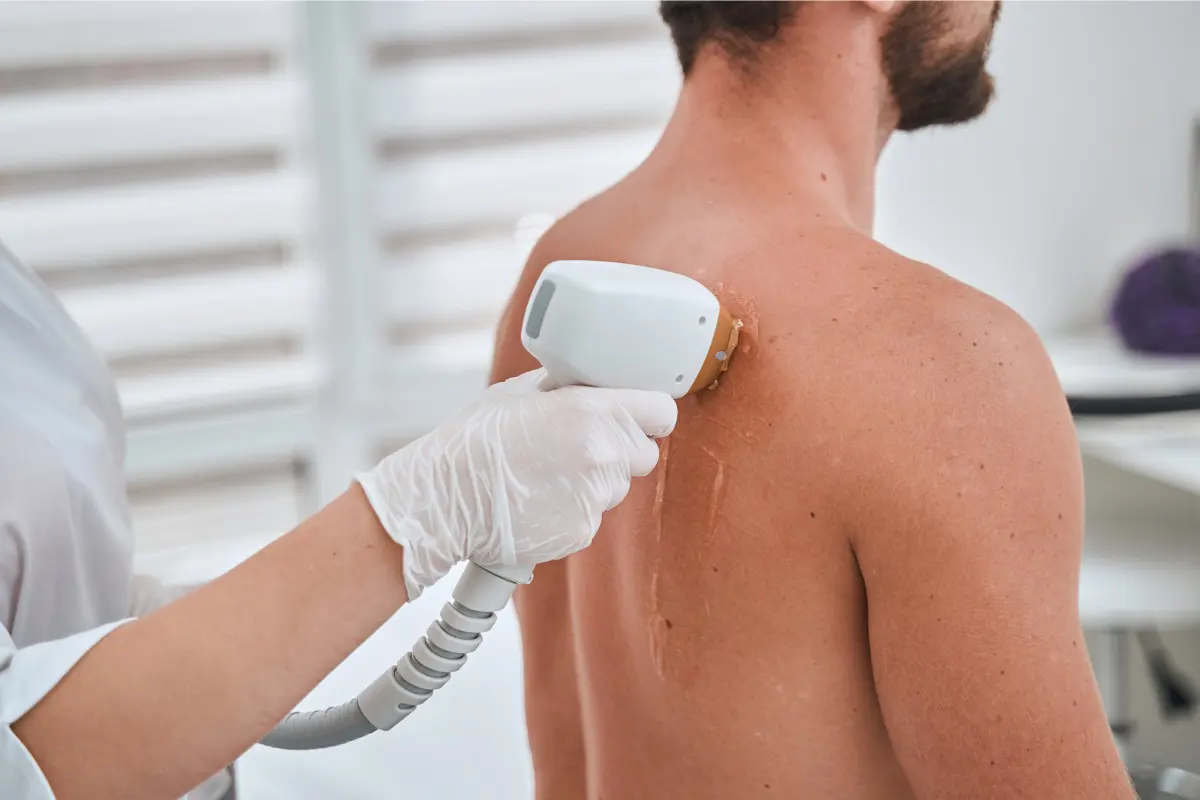 Expert Laser Hair Removal for Face and Body
